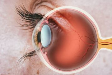 Leer noticia sobre:   23 October 2025  
 Signs of a retinal problem that you shouldn't ignore 