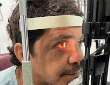 Leer noticia sobre:   05 April 2024  
 Glaucoma Social Operation 2024 