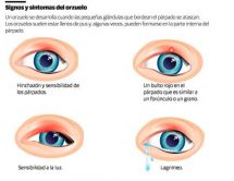 Leer noticia sobre:   19 May 2019  
 El orzuelo ¿Cómo prevenir su aparición?. Diario Libre  