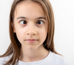 Strabismus: when the eyes do not look in the same direction