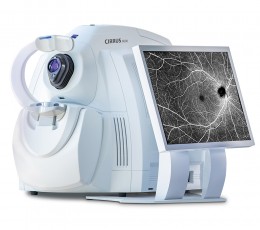 What is the OCT study for?