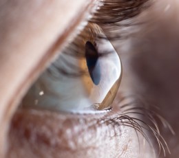 Keratoconus Treatment: Options to Improve Vision and Preserve Corneal Health