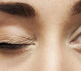 &iquest;Qu&eacute; es el blefaroespasmo?