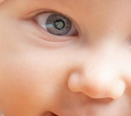 Catarata cong&eacute;nita