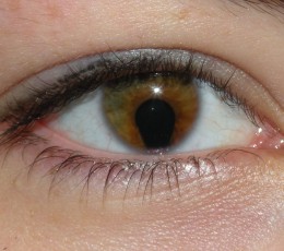What is coloboma?