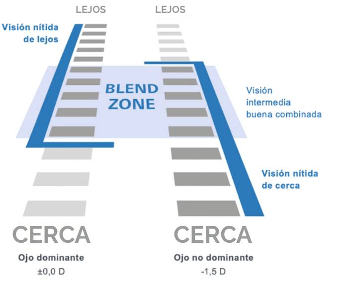  How does Presbyond work? 