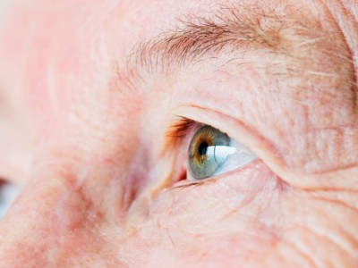 ¿Conoces los tipos de degeneración macular asociada con la edad?