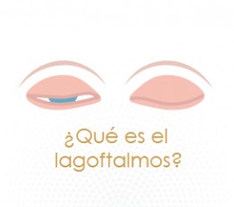 Lagoftalmos