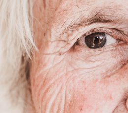 &iquest;Qu&eacute; es un linfoma ocular?