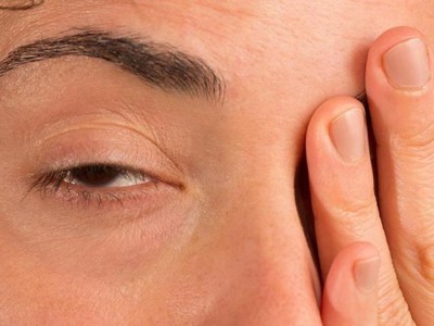 Everything you need to know about ocular myasthenia