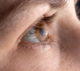 ¿Qué es el crosslinking corneal?