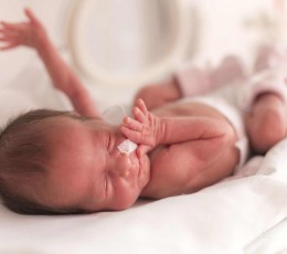 Retinopathy of prematurity